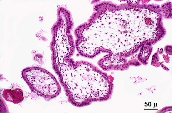 Portfolio Image 5